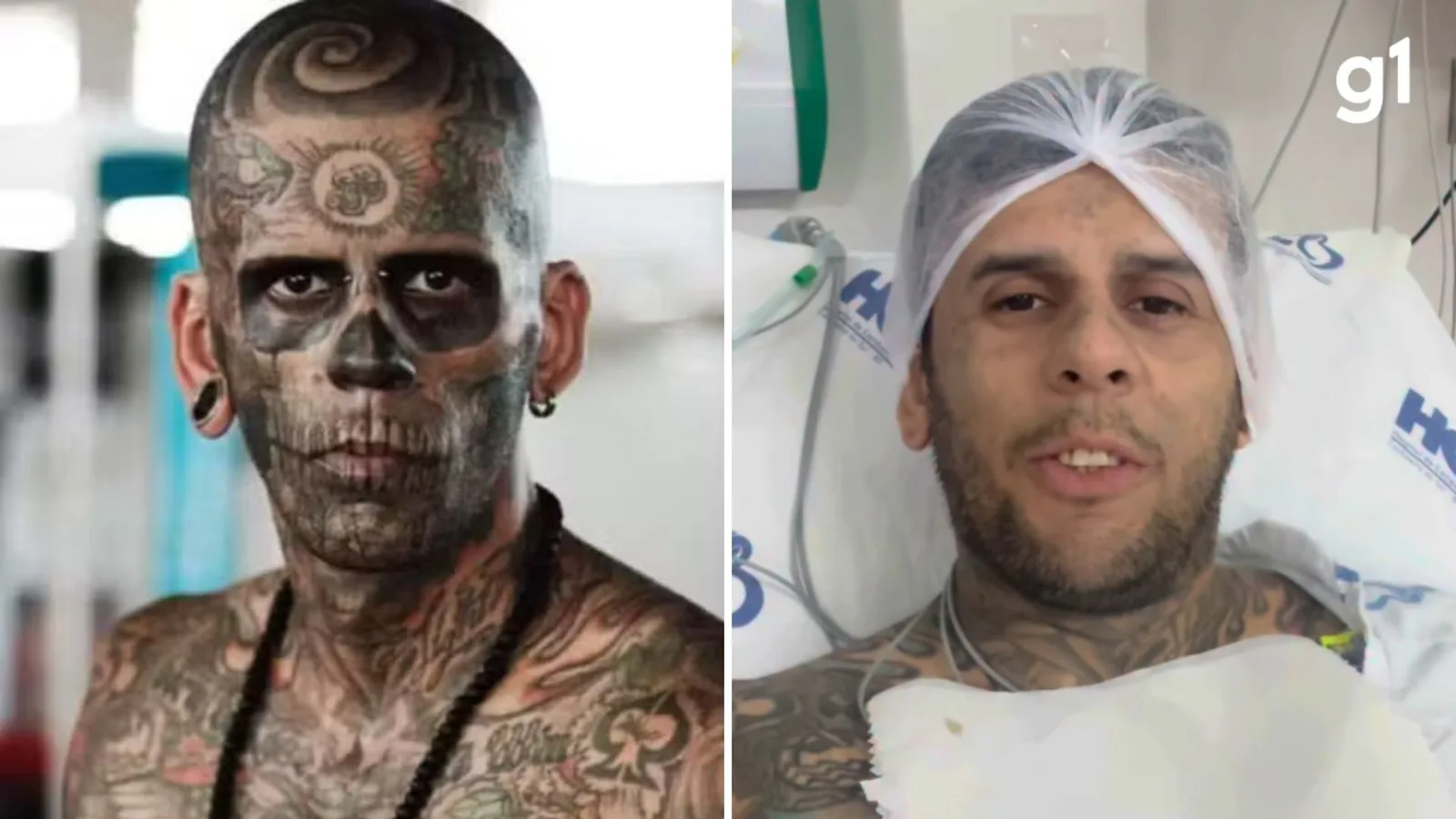 Leandro de Souza retira tumor da bexiga e aguarda resultado de biópsia