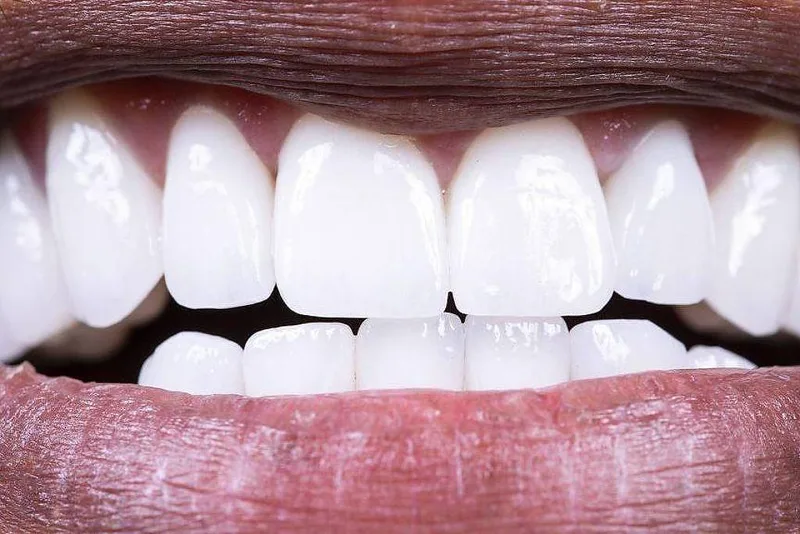 Alimentação ajuda a equilibrar bactérias da boca e proteger os dentes