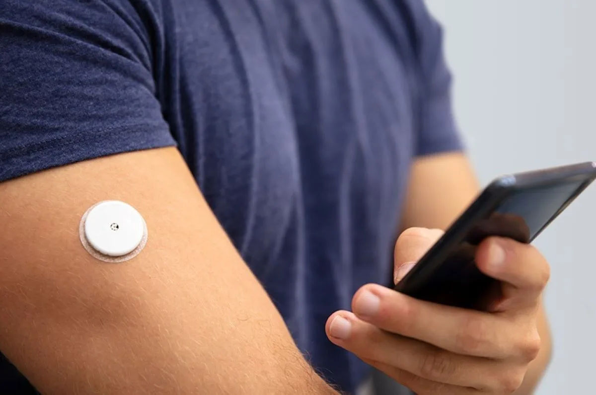 Divinópolis autoriza sensor de glicose gratuito, condicionado ao orçamento de 2027