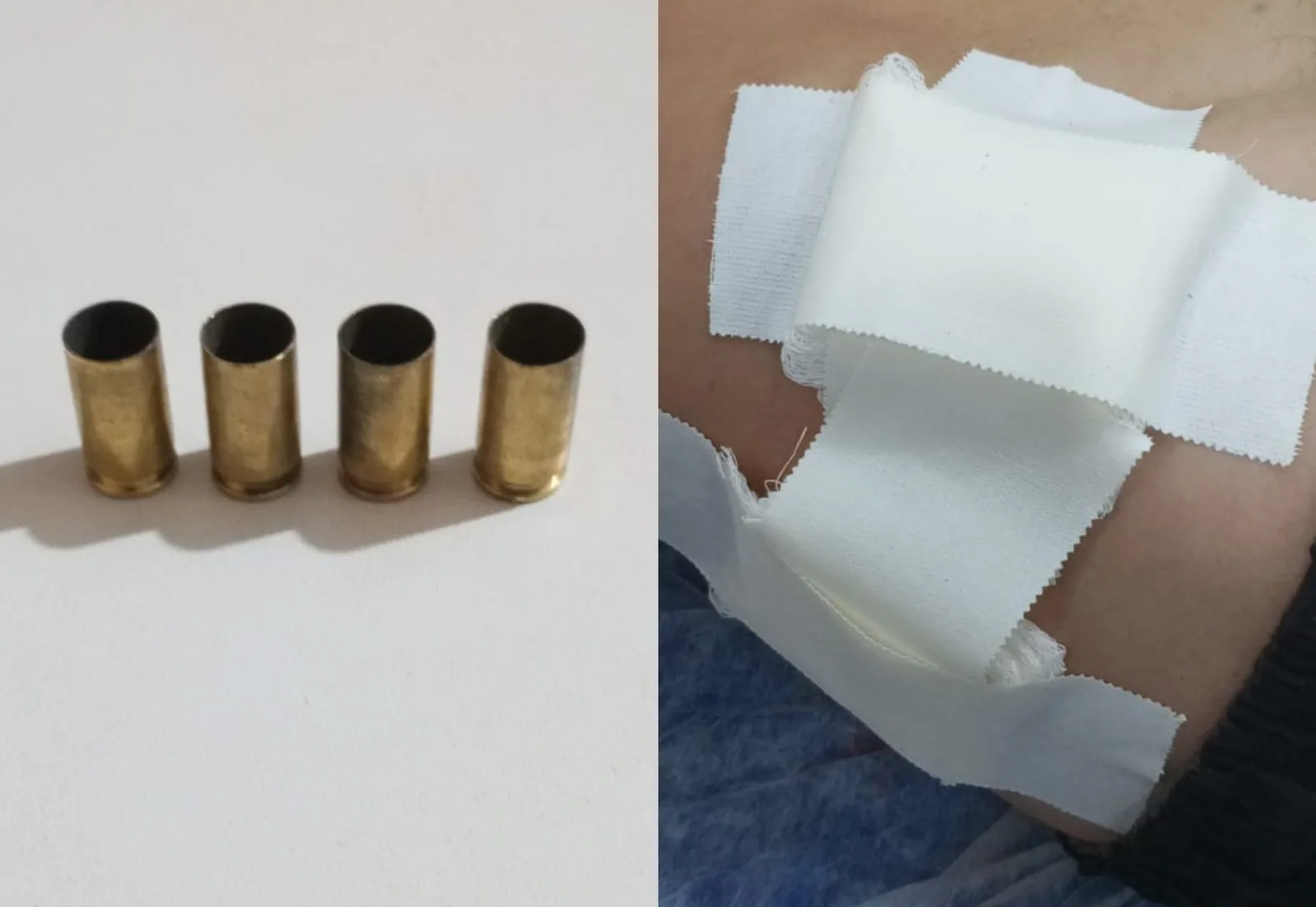 Jovem é atingido no tórax durante tentativa de assalto em Boa Vista
