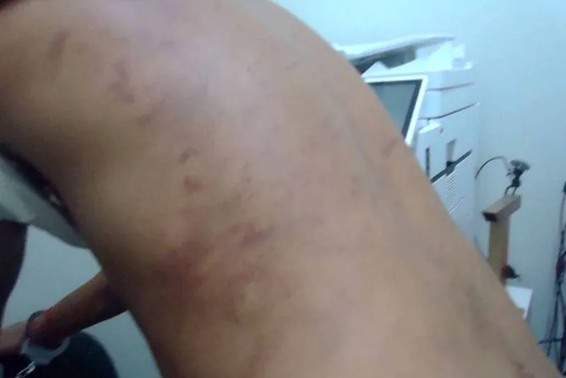 MP apura relatos de tortura contra presos em unidades do agreste pernambucano
