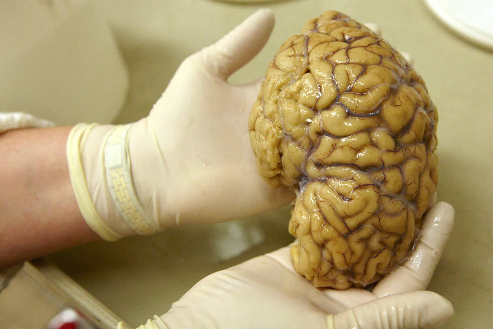 Mapa genético do córtex pré-frontal amplia pistas sobre doenças cerebrais