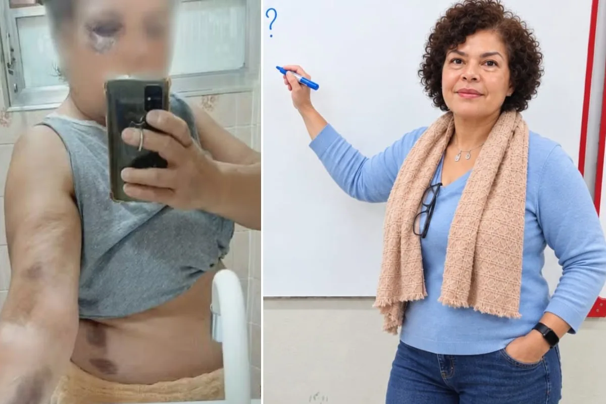 Professora agredida em Cubatão contesta indenização de R$ 5 mil do Estado