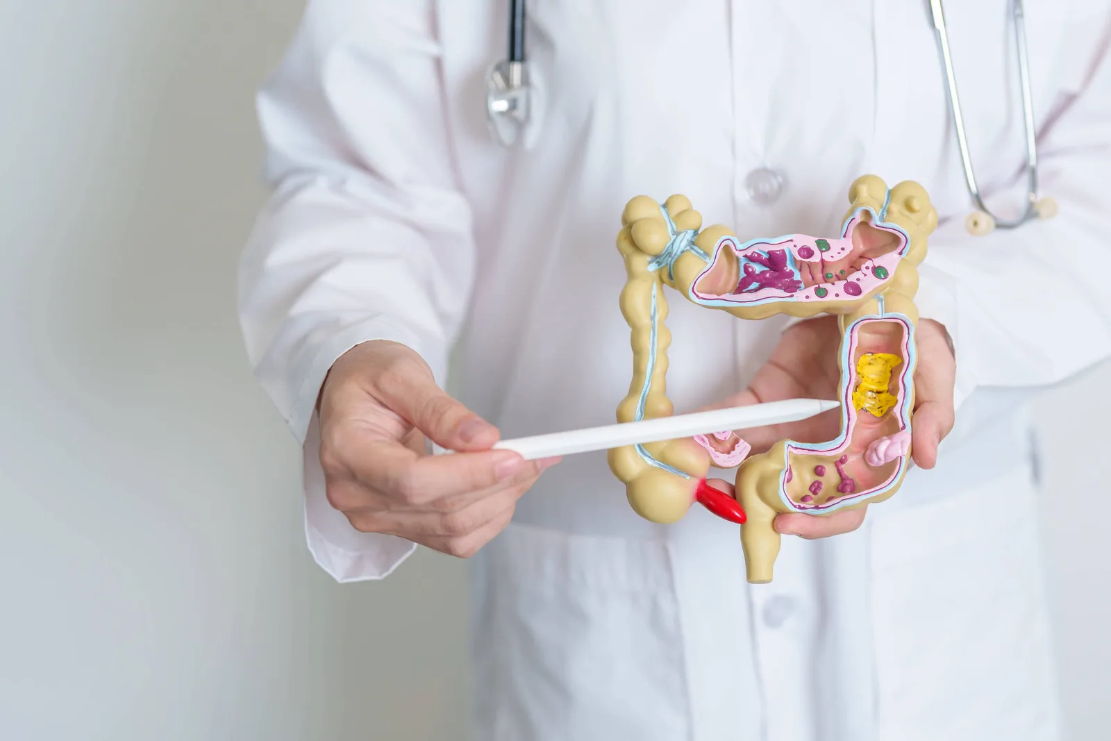 Doenças inflamatórias intestinais avançam 427% no Brasil desde 2012