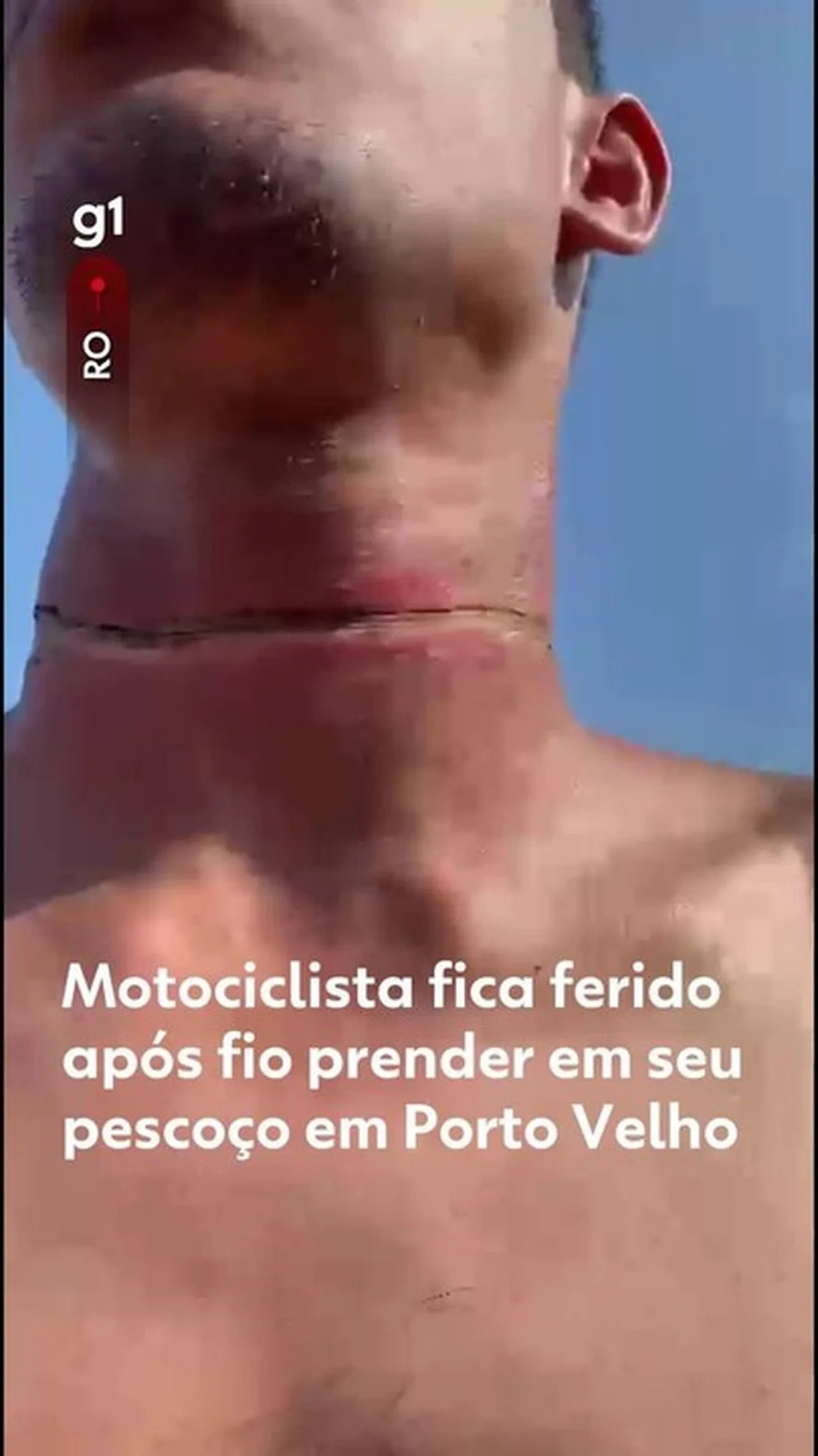Fio de telecomunicação causa corte no pescoço de motociclista em Porto Velho
